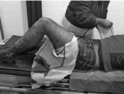 Police Shoot and Arrest Two Indian Drug Smugglers in Jhapa